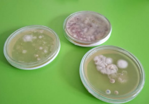 Naczynia z hodowlą bakterii.